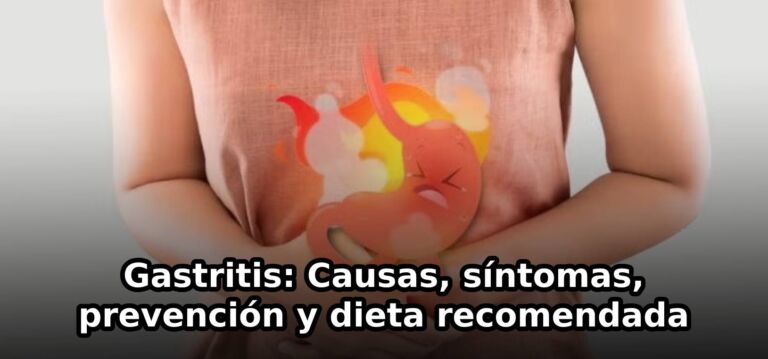 Gastritis: Causas, síntomas, prevención y dieta recomendada